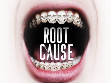 Root Cause