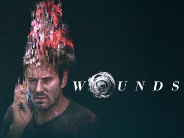 Wounds